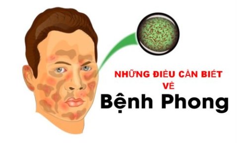 NHỮNG ĐIỀU CẦN BIẾT VỀ BỆNH PHONG VÀ CÁCH PHÒNG BỆNH PHONG